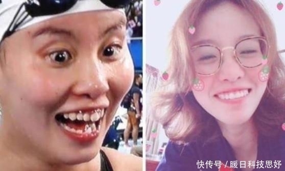 整容|中国体坛“洪荒之力”整容?傅园慧整牙后颜值瞬间逆天