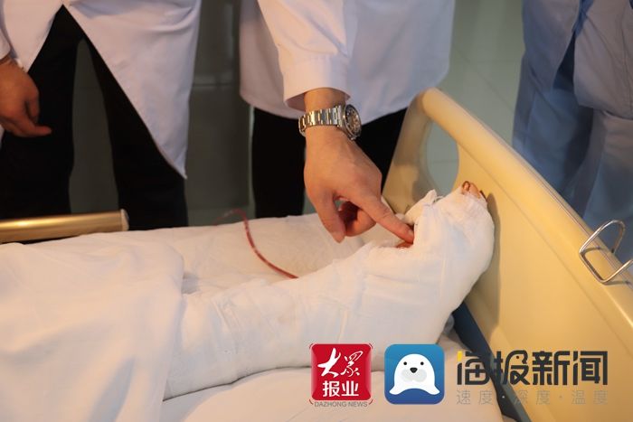 田效卿|“手护神”田效卿：历时3个多小时，完成腓肠神经带蒂皮瓣移植术