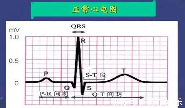 心率|50岁以后，5个长寿特征，全占的人，可能容易活过100岁