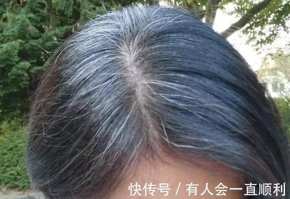 惜丝|惜丝：头发变白是怎么回事？快转给你关心的人！