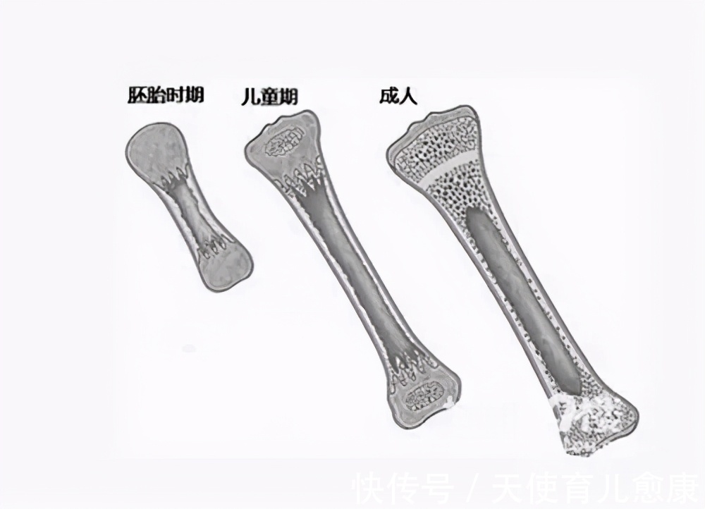 发育|天使科普:长高也有关键期,“骨龄”很重要!