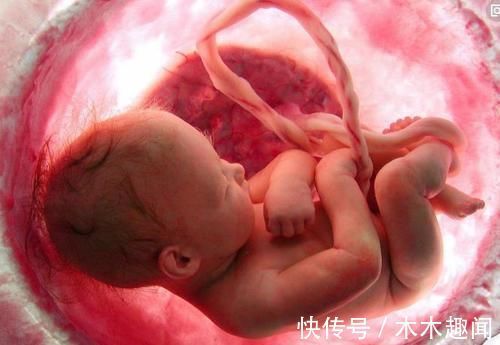 脐带|胎儿脐带绕颈有风险,孕妈少做以下三件事,做多了可能绕得多