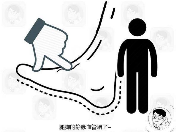 体内有血栓,四肢先知提醒四肢出现这4种异常,是血栓信号