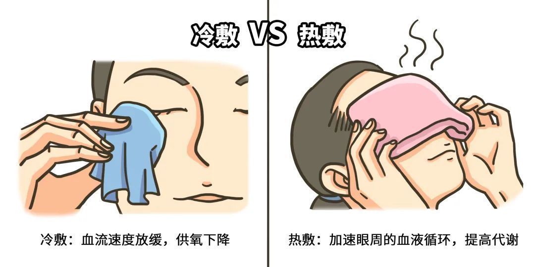 黑眼圈很严重怎么办？怎么拯救特别严重的黑眼圈？