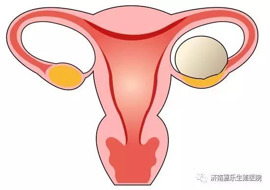 备孕|有子宫肌瘤还能正常怀孕吗？