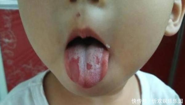 山楂|2个水果煮水，分分钟健脾强胃！孩子不蹬被，吃饭香，身高蹭蹭长