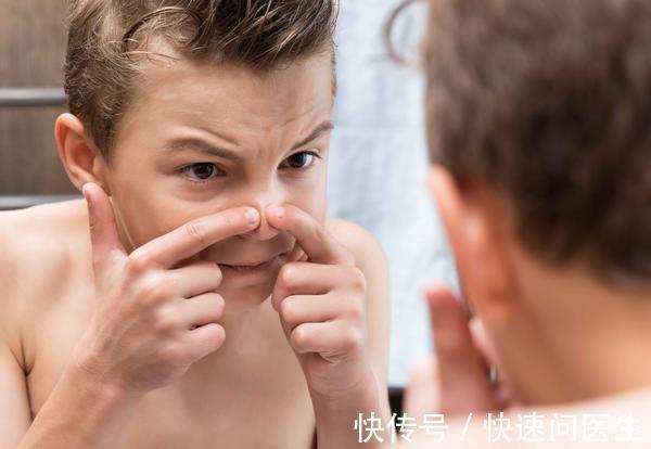 彩妆 脸上长了痘痘?不用着急,分享4招,帮助脸庞恢复白净