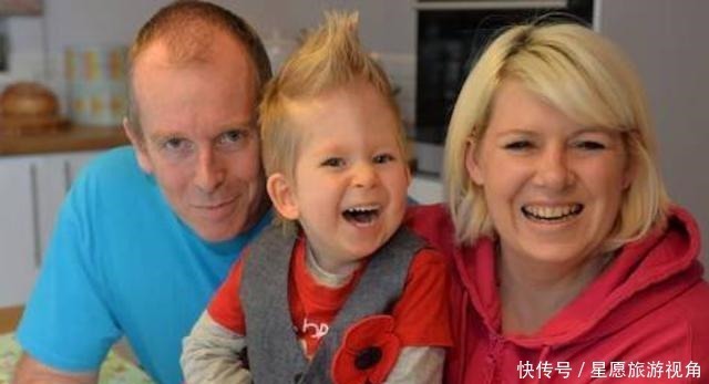 医生们|生下“无脑”宝宝吓坏众人,夫妻细心照顾三年,如今现状堪称奇迹