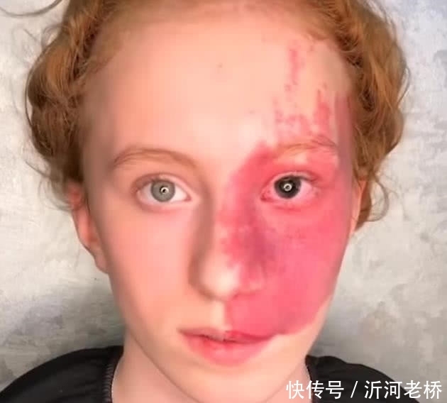脸上|奇闻:女孩满脸胎记被嘲笑,化妆后瞬间涨粉80w,网友:易容术