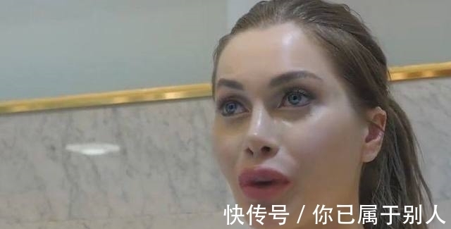 美国 美国一女子去韩国做危险极高的额骨手术,还说整容上瘾