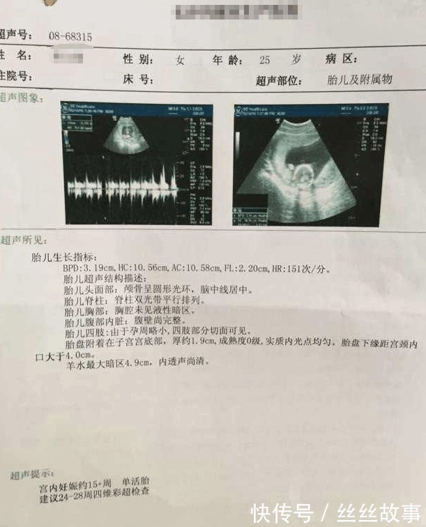 b超单|B超单上的这4个字是什么意思 别担心, 别人羡慕还来不及呢