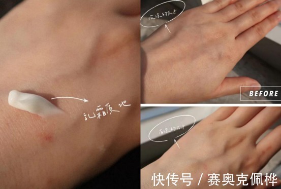 精华乳|妊娠纹只要长出来就是一辈子!拒绝“西瓜肚”辣妈分享去纹心经