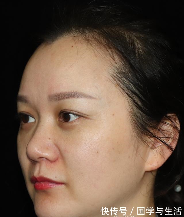 作用 热玛吉的作用怎么样!