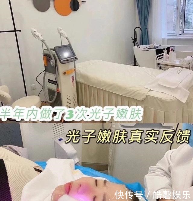 橡皮筋弹 半年内做了3次光子嫩肤，光子嫩肤真实反馈！