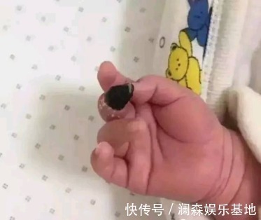 截肢|宝爸宝妈们,这些东西你家都有,它可能会导致宝宝面临截肢!