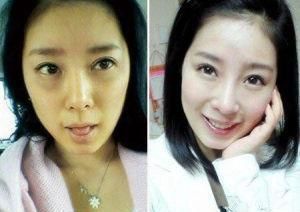 面色暗淡或面色发黄,没准是身体发出的警报!