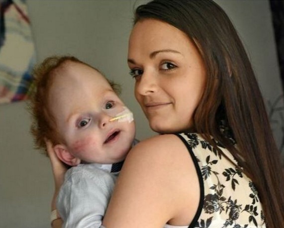 夫妇俩|男孩天生无大脑,医生断言很难存活,他的父母却让奇迹出现了