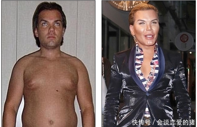 整得|33岁男子整容上瘾,花了百万巨资整容62次,鼻子被整得无法呼吸