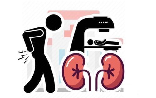 泡沫|尿液是疾病的“报警器”,如果出现4种迹象,尽快去医院检查一下