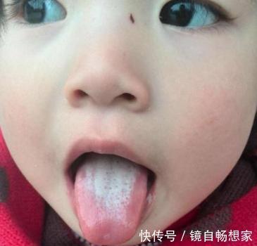 脾胃|它是脾胃的“吸尘器”，隔三差五给孩子喝点，清理积食个头猛长