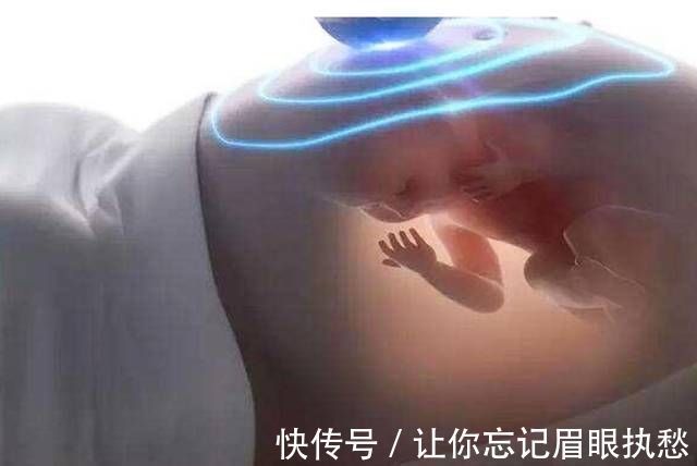 生男生女|先破水的是男孩？医生：和性别无关，暗示了胎儿的发育好坏