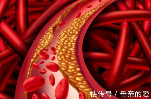 三甲胺|红肉被列为致癌物,经常吃牛肉、猪肉会患癌?一文说清