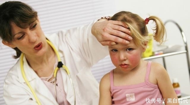 贝诺酯|惊出一身冷汗！小儿发烧别用这个药，家长一定要记好
