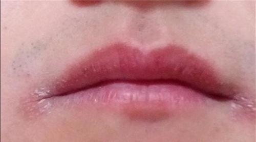 克星|几块钱一瓶的维生素B2却是高血压的“克星”!大多数人都不知道