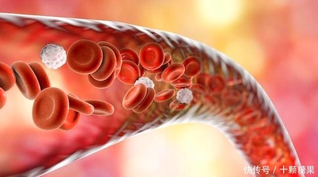 脑梗不是突然发生的,3件事少做,4样东西多吃,