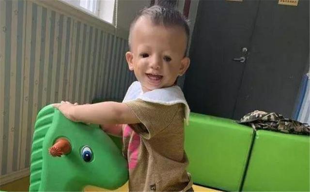 王女士|还记得那个25岁的“鸟脸妈妈”吗?孩子不幸遗传疾病,如今怎样