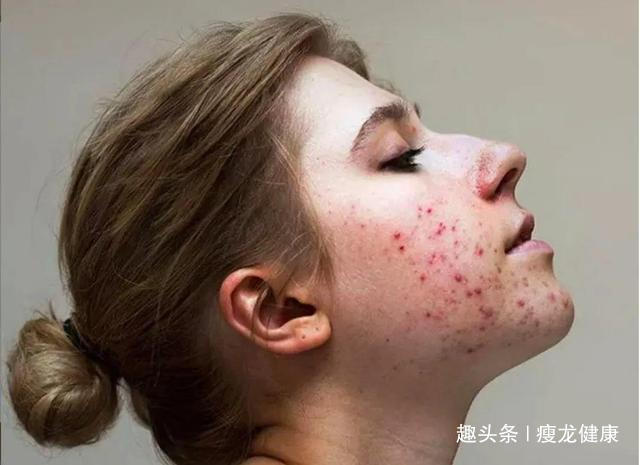 谷物|除了少吃糖和谷物，哪些食物有利于皮肤的营养，什么对皮肤最重要