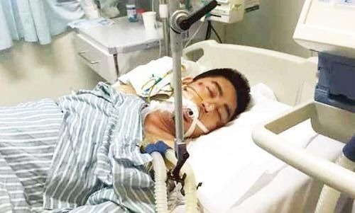 酒精|肝癌是酒“泡”出来的?两个部位很臭,最好去检查一下肝脏CT