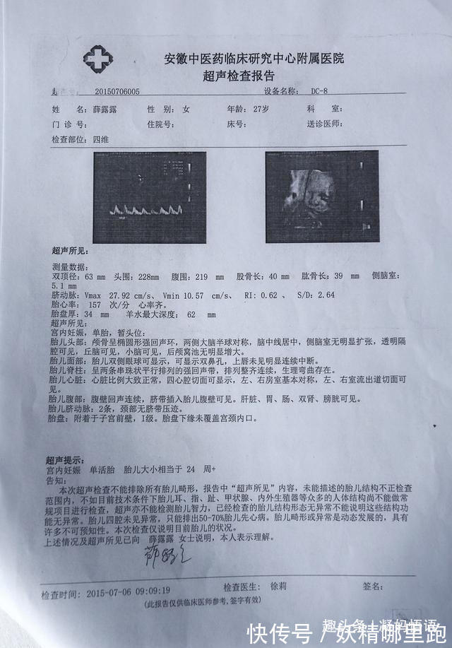 认识|孕期要做四维彩超,四维彩超的这些误区和认识,孕妈妈早知道早好