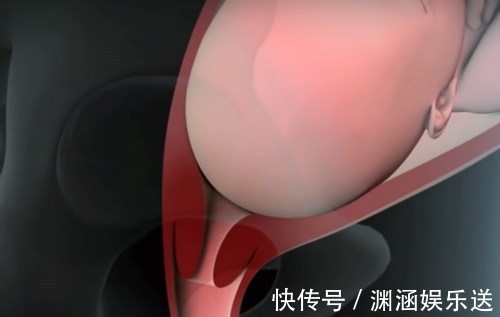 小李|产道那么小婴儿是怎么出来的这张图很生动,看完感叹母爱伟大