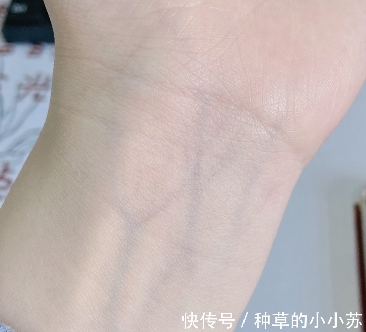 皮肤科|油皮“长期”用皂基洗面奶洗脸真的会烂脸吗?皮肤科主任这样建议