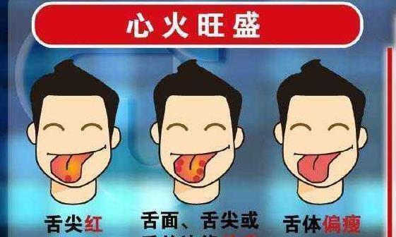 肺不好的人,身体会有“1多,2大,3黑”,若没有,肺部很健康