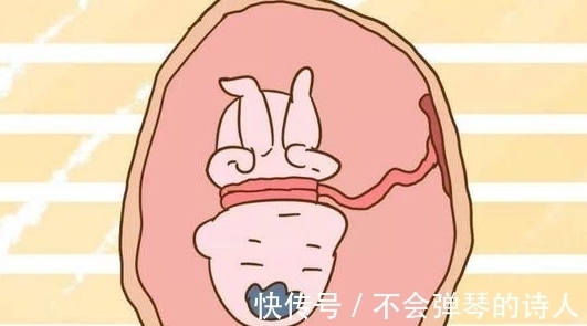 怀孕|怀孕之后,如果不想胎儿脐带绕颈,请尽快改正以下4种坏习惯!