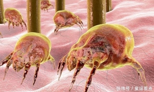 起床洗脸后没有这3个现象,说明脸上一只螨虫都没有,恭喜你