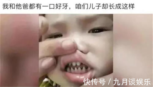 孩子|儿子长了一口“鲨鱼牙”,妈妈连忙送医,医生无知害了孩子