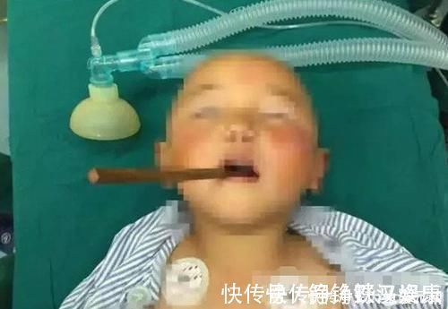 零件|儿子误将502滴入眼中,爸爸“教科书式”方法救了孩子,医生:高明