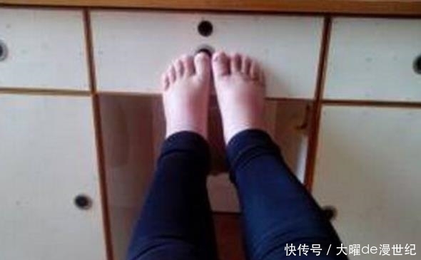  不错|肝好不好？脚先知！若脚上没有3个“标记”，恭喜，肝脏还不错