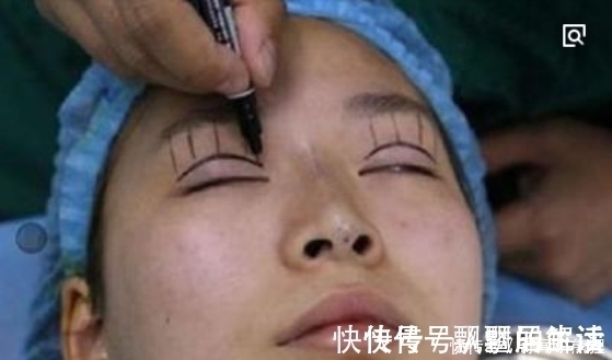双眼皮|手术割了双眼皮的人,老了之后有什么影响?看完真要留意了