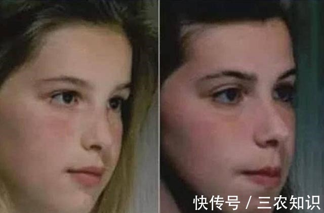医美 明明没医美，为什么身边人突然变好看了坚持做到这3点，你也行！
