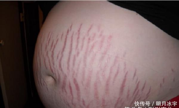 拉伸|两闺蜜同时怀孕,掀开衣服看到肚子时,对比太扎心了