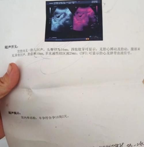 怀孕|怀孕二个多月,突然起身或躺下会感觉到胎动,这是怎么回事?