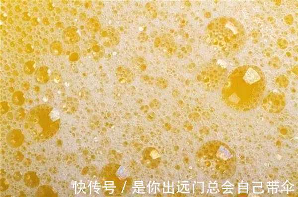 尿液|男性晨起“第一泡尿”，若有这三个特征，那就恭喜你，肾脏还不错