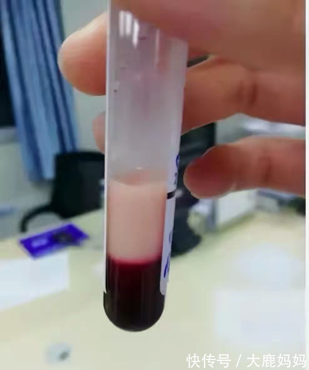 高血压|孕妇体重130斤!9.5斤“巨大儿”高血压、皮质醇增多症接踵而至