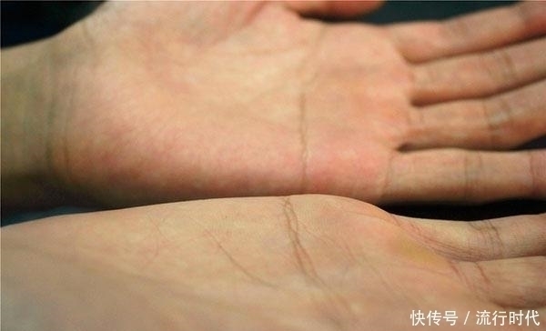 身体健硕|脾虚不能随便补,健脾的对照症状来,医生和您详解养脾胃的方法