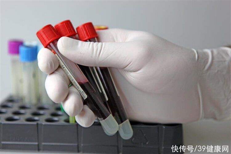 老伯|76岁老伯感染梅毒，过程公开：老伴去世多年，怎么可能是梅毒？