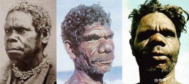 肢解|残酷的种族灭绝最后幸存者只求留个全尸,刚去世便遭肢解